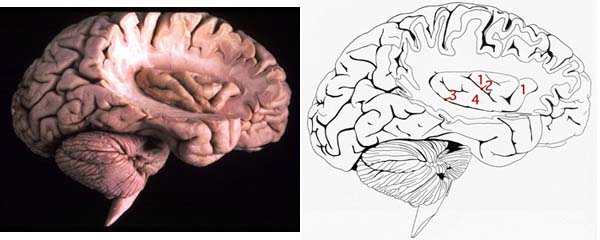 insula of right hemisphere